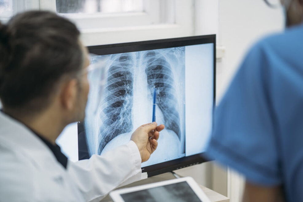Tuberkulose-Verdacht: Röntgenbild des Brustkorbs