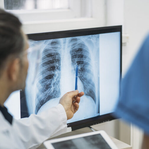 Tuberkulose-Verdacht: Röntgenbild des Brustkorbs