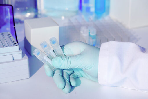 PCR-Tests werden im Labor ausgewertet